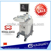 DW370 Trolley ultrasound system and medical device